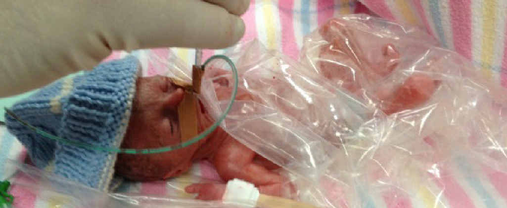 TOO TINY: Little Jye (pictured at birth) is now more than six months old and weighs almost 4kg but is still on oxygen because of problems with his lungs. TOO TINY: Little Jye (pictured at birth) is now more than six months old and weighs almost 4kg but is still on oxygen because of problems with his lungs.